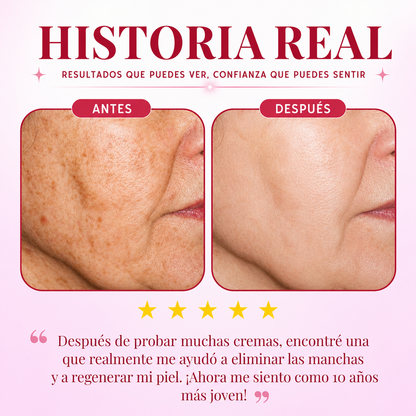 DragoCream con Retinol | La misma piel, 10 años más joven | Promoción 2x2 solo por hoy